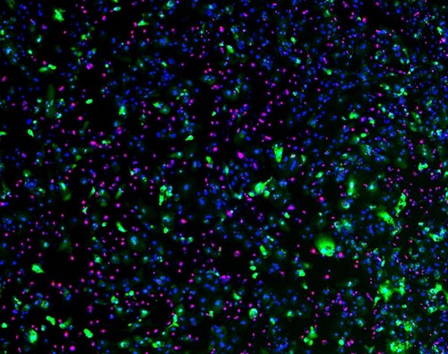 CIL:39213, Homo sapiens, cardiomyocytes