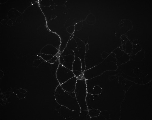 CIL:36177, Rattus, multipolar neuron