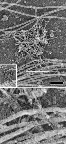 CIL:40952, Rattus, hippocampal neuron