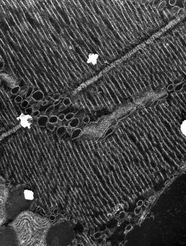 CIL:37378, damselfly, flight muscle cell