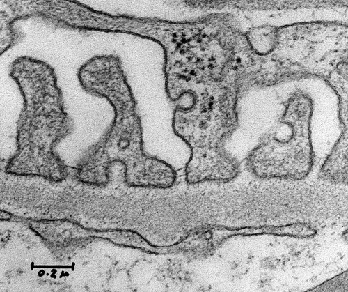 CIL:37176, Rattus, glomerular endothelial cell, kidney cell, podocyte