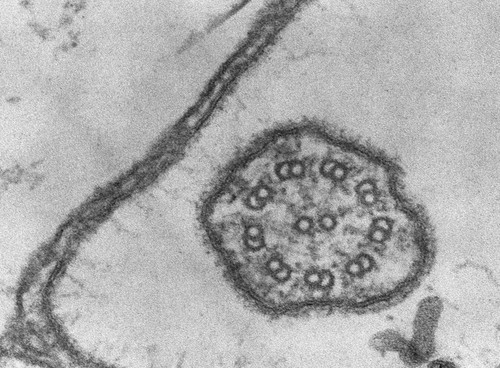 CIL:2871, Coleps hirtus, eukaryotic cell, Eukaryotic Protist, Ciliated Protist