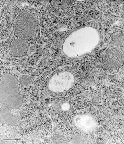 CIL:36769, Paramecium caudatum, cell by organism, eukaryotic cell, Eukaryotic Protist, Ciliated Protist