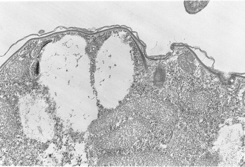 CIL:2857, Colpoda cucullus, cell by organism, eukaryotic cell, Eukaryotic Protist, Ciliated Protist