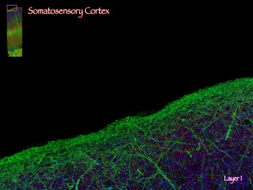 CIL:41403, Mus musculus, neuron