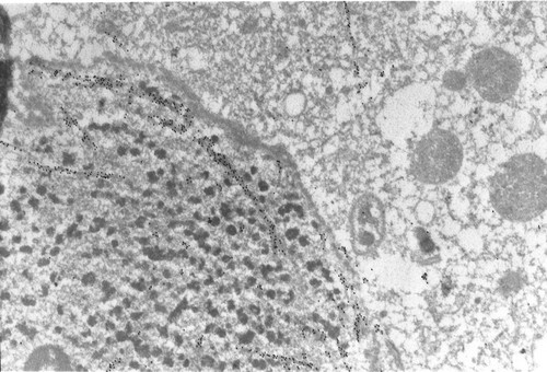 CIL:1310, Paramecium tetraurelia, cell by organism, eukaryotic cell, Eukaryotic Protist, Ciliated Protist