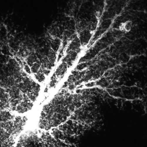 CIL:36364, Rattus norvegicus, astrocyte, astrocyte of the hippocampus