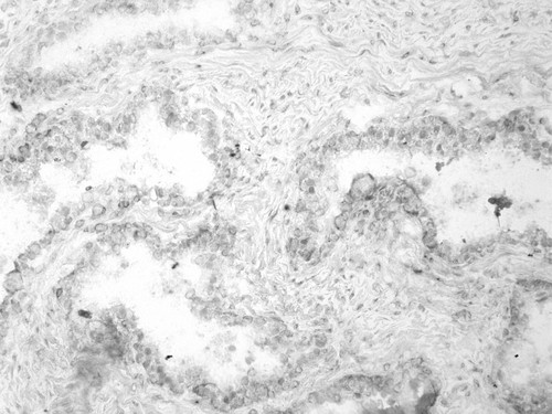 CIL:33548, Homo sapiens, endocrine-paracrine cell of prostate gland, basal cell of prostate epithelium, luminal cell of prostate epithelium, blood vessel endothelial cell, perineural cell, sheath cell, leukocyte, prostate stromal cell, smooth muscle cell of prostate