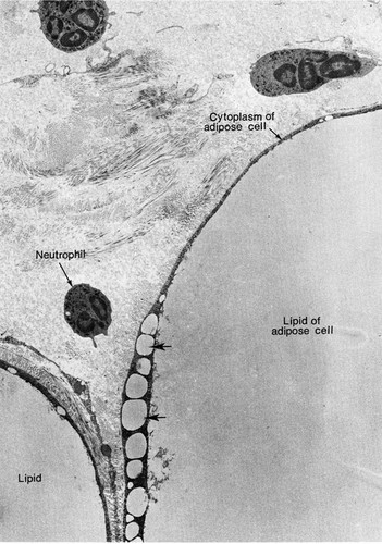 CIL:35983, Rattus, fat cell