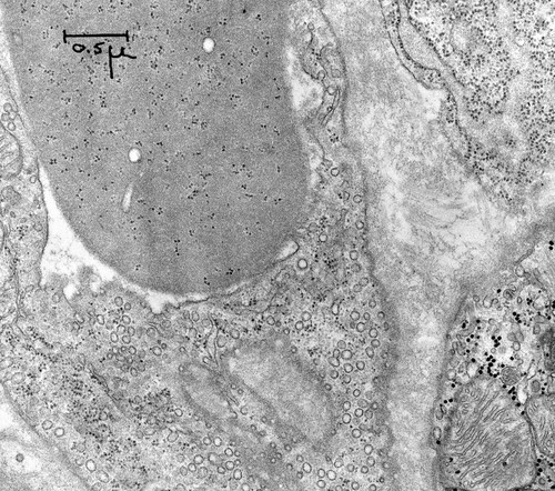 CIL:40997, Rattus rattus, reticulocyte