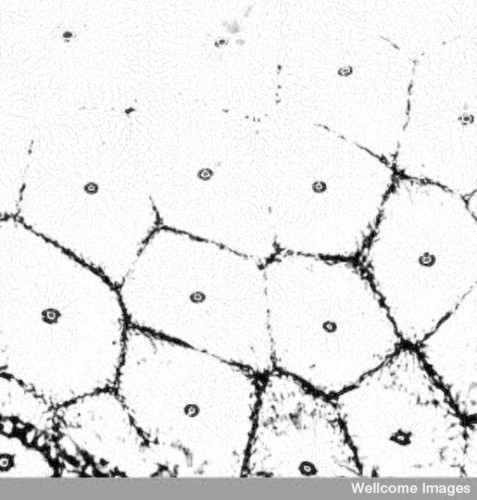 CIL:38914, Homo sapiens, mucin cells