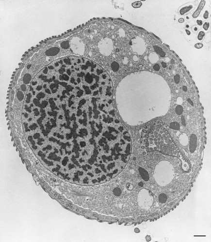 CIL:9808, Opercularia [NCBITaxon:168247], Opercularia coarctata, cell by organism, eukaryotic cell, Eukaryotic Protist, Ciliated Protist