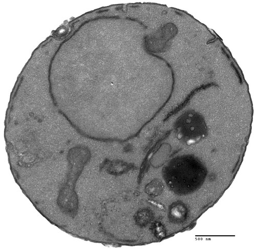 CIL:40425, Saccharomyces cerevisiae, drs2Δ mutant