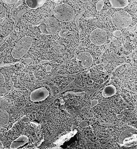 CIL:36615, Paramecium multimicronucleatum, cell by organism, eukaryotic cell, Eukaryotic Protist, Ciliated Protist