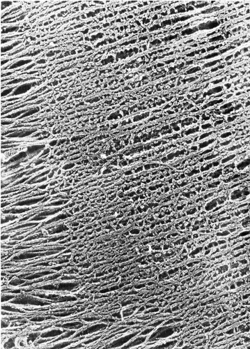 CIL:36061, skeletal muscle cell