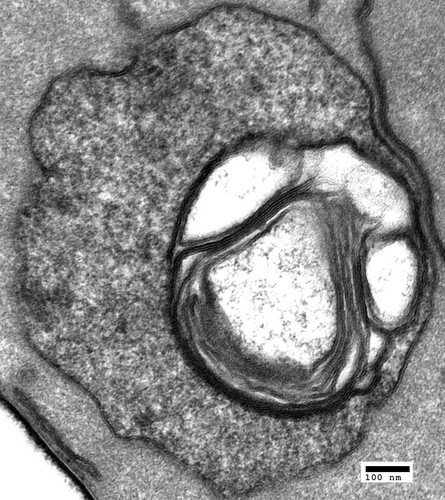 CIL:40442, Saccharomyces cerevisiae, drs2∆ mutant