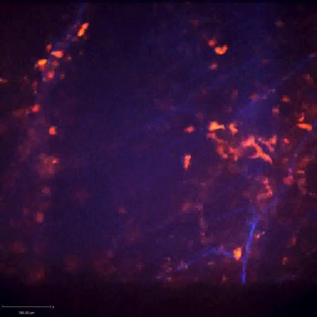 CIL:47563, Staphylococcus aureus, neutrophil, endothelial cell