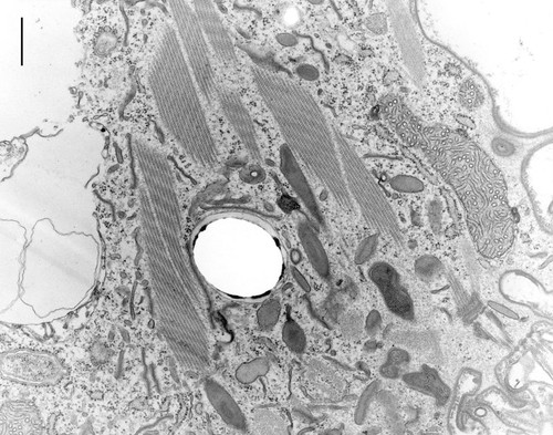 CIL:9710, Coleps hirtus, eukaryotic cell, Eukaryotic Protist, Ciliated Protist