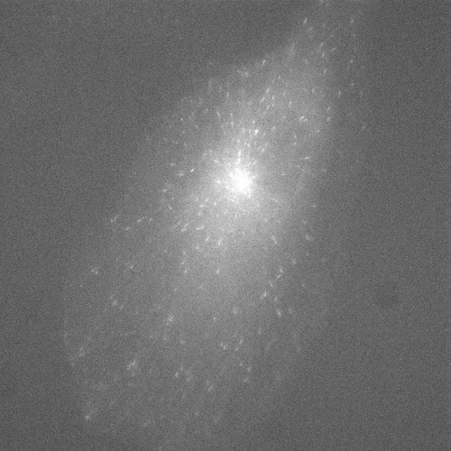 CIL:32024, Homo sapiens, epithelial cell, renal cell carcinoma