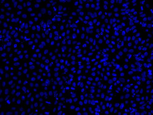 CIL: 54753, Homo sapiens, SBAD2 human iPSC line