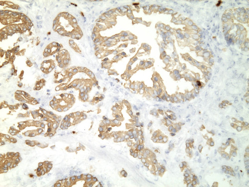 CIL:34247, Homo sapiens, endocrine-paracrine cell of prostate gland, basal cell of prostate epithelium, luminal cell of prostate epithelium, blood vessel endothelial cell, perineural cell, sheath cell, leukocyte, prostate stromal cell, smooth muscle cell of prostate