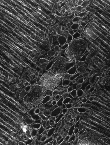 CIL:36129, damselfly, flight muscle cell