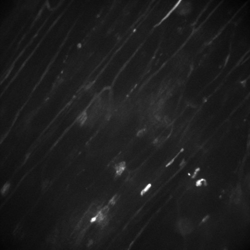 CIL:47302, Staphylococcus aureus, neutrophil, endothelial cell