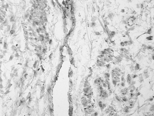 CIL:32370, Homo sapiens, endocrine-paracrine cell of prostate gland, basal cell of prostate epithelium, luminal cell of prostate epithelium, blood vessel endothelial cell, perineural cell, sheath cell, leukocyte, prostate stromal cell, smooth muscle cell of prostate