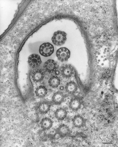 CIL:9905, Euplotes sp., cell by organism, eukaryotic cell, Eukaryotic Protist, Ciliated Protist