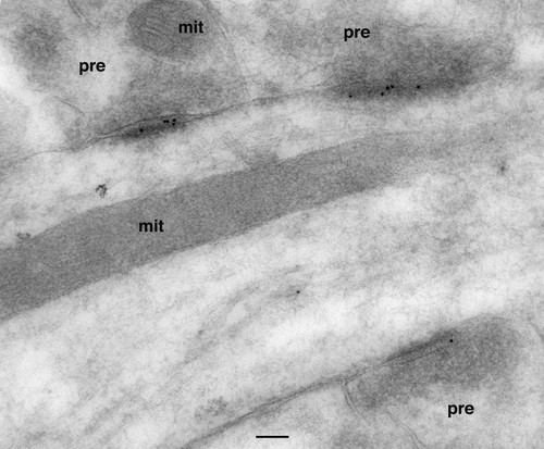 CIL:9151, Rattus, interneuron