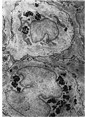 CIL:11536, Macaca mulatta, epithelial cell