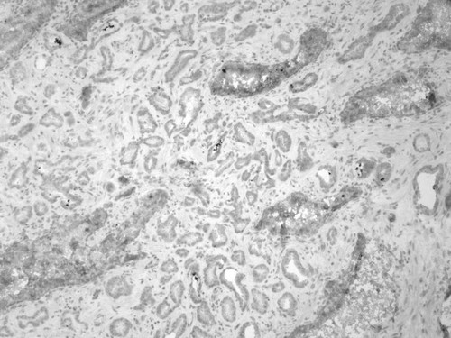 CIL:32232, Homo sapiens, endocrine-paracrine cell of prostate gland, basal cell of prostate epithelium, luminal cell of prostate epithelium, blood vessel endothelial cell, perineural cell, sheath cell, leukocyte, prostate stromal cell, smooth muscle cell of prostate