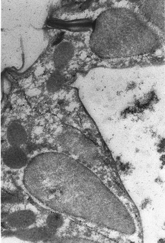 CIL:1308, Paramecium tetraurelia, cell by organism, eukaryotic cell, Eukaryotic Protist, Ciliated Protist