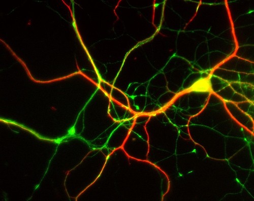 CIL:8737, Rattus, multipolar neuron