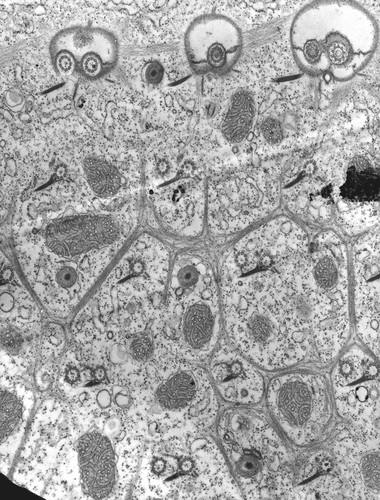 CIL:39306, Paramecium multimicronucleatum, cell by organism, eukaryotic cell, Eukaryotic Protist, Ciliated Protist