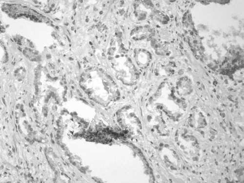 CIL:32201, Homo sapiens, endocrine-paracrine cell of prostate gland, basal cell of prostate epithelium, luminal cell of prostate epithelium, blood vessel endothelial cell, perineural cell, sheath cell, leukocyte, prostate stromal cell, smooth muscle cell of prostate