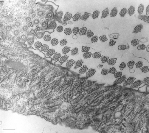 CIL:36703, Paramecium multimicronucleatum, cell by organism, eukaryotic cell, Eukaryotic Protist, Ciliated Protist