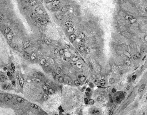 CIL:48201, Mus musculus, parietal cell, zymogen, mucus