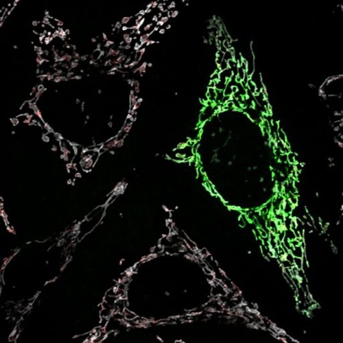 CIL:13729, Homo sapiens, endothelial cell