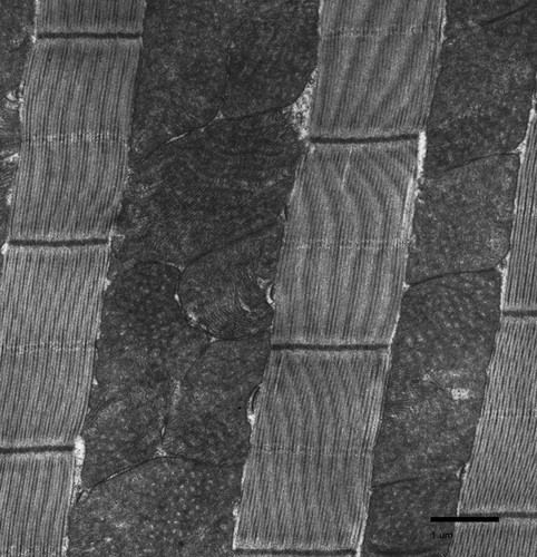 CIL:34561, Drosophila melanogaster, flight muscle cell