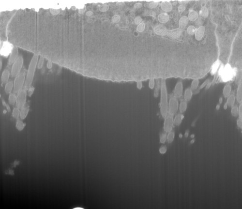 CIL: 50704, FIB-SEM Dataset of anti-PKHD1L1 Immuno-Gold Labeled Outer Hair Cell Stereocilia Bundles