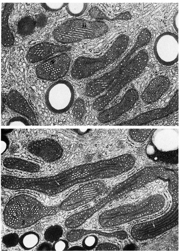 CIL:11441, Spermophilus citellus, Leydig cell