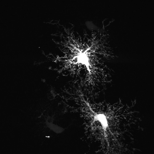 CIL:40173, Rattus norvegicus, astrocyte, astrocyte of the hippocampus