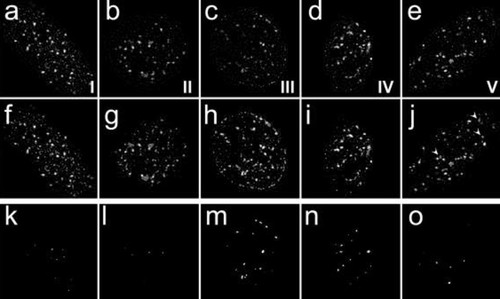 CIL:39333, Homo sapiens, epithelial cell