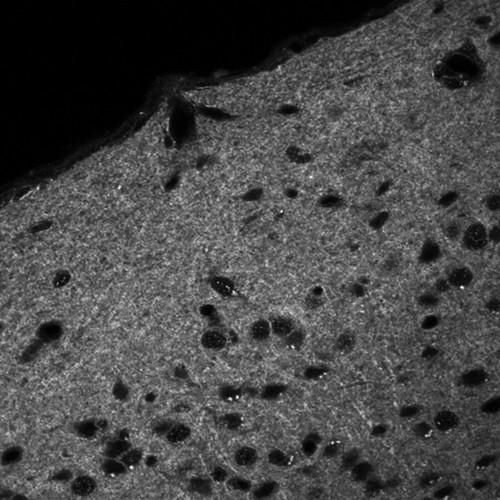 CIL:40138, Mus musculus, CNS neuron (sensu Vertebrata)