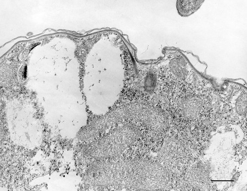 CIL:12110, Colpoda cucullus, cell by organism, eukaryotic cell, Eukaryotic Protist, Ciliated Protist