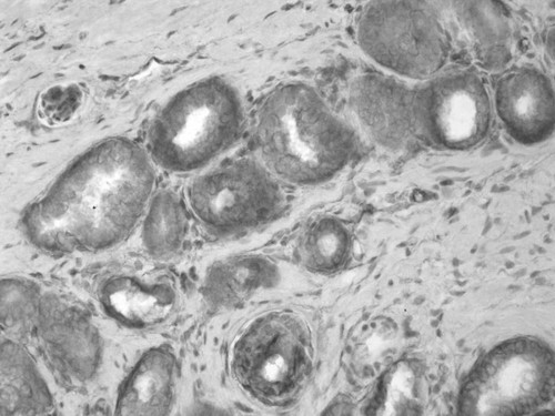 CIL:33934, Homo sapiens, endocrine-paracrine cell of prostate gland, basal cell of prostate epithelium, luminal cell of prostate epithelium, blood vessel endothelial cell, perineural cell, sheath cell, leukocyte, prostate stromal cell, smooth muscle cell of prostate