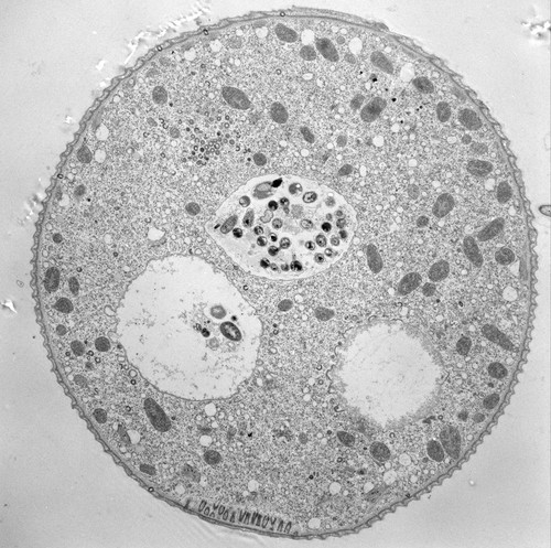 CIL:39327, Vorticella convallaria, cell by organism, eukaryotic cell, Eukaryotic Protist, Ciliated Protist