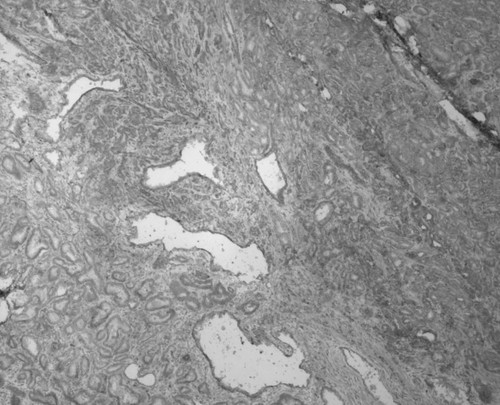 CIL:33593, Homo sapiens, endocrine-paracrine cell of prostate gland, basal cell of prostate epithelium, luminal cell of prostate epithelium, blood vessel endothelial cell, perineural cell, sheath cell, leukocyte, prostate stromal cell, smooth muscle cell of prostate