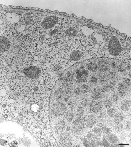 CIL:36261, Vorticella convallaria, cell by organism, eukaryotic cell, Eukaryotic Protist, Ciliated Protist